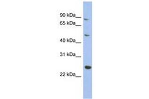 Image no. 1 for anti-Matrilin 3 (MATN3) (AA 215-264) antibody (ABIN6744056) (Matrilin 3 抗体  (AA 215-264))