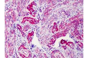 Human Uterus: Formalin-Fixed, Paraffin-Embedded (FFPE) (SLC5A3 抗体)