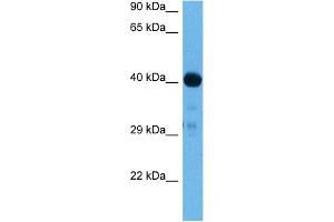 Western Blotting (WB) image for anti-SMAD, Mothers Against DPP Homolog 1 (SMAD1) (N-Term) antibody (ABIN2780719)