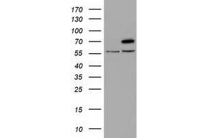 Western Blotting (WB) image for anti-Tripartite Motif Containing 2 (TRIM2) (AA 1-100), (AA 645-744) antibody (ABIN1490545) (TRIM2 抗体  (AA 1-100, AA 645-744))