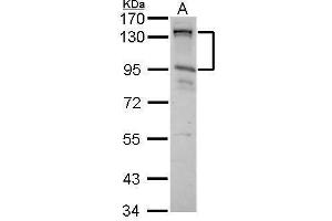 WB Image CIZ1 antibody [N2C1], Internal detects CIZ1 protein by Western blot analysis. (CIZ1 抗体)