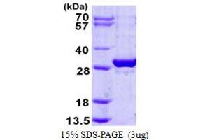 Exosome Component 5 (EXOSC5) protein (His tag)