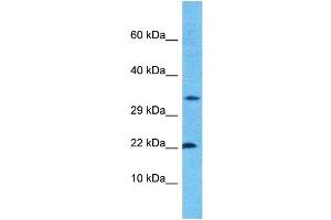 Host:  Rabbit  Target Name:  CROC4  Sample Type:  ACHN Whole Cell lysates  Antibody Dilution:  1. (C1orf61 抗体  (N-Term))