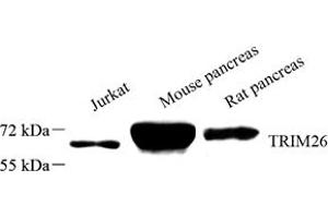 Western blot analysis of KUB3 (ABIN7074637),at dilution of 1: 2000 (Mitochondrial Inner Membrane Protease ATP23 Homolog (ATP23) 抗体)