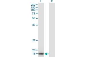 Western Blot analysis of SNX3 expression in transfected 293T cell line by SNX3 monoclonal antibody (M05), clone 3D7. (Sorting Nexin 3 抗体  (AA 1-113))