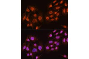 Immunofluorescence analysis of C6 cells using // antibody (ABIN7265520) at dilution of 1:100. (AKT 1/2/3 抗体)