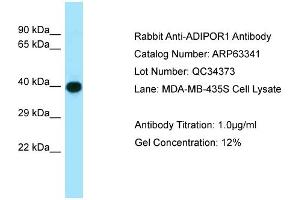 Western Blotting (WB) image for anti-Adiponectin Receptor 1 (ADIPOR1) (C-Term) antibody (ABIN2789457) (Adiponectin Receptor 1 抗体  (C-Term))
