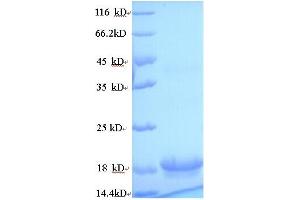 SDS-PAGE (SDS) image for Interleukin 10 (IL10) (AA 19-178) protein (His tag) (ABIN5713542) (IL-10 Protein (AA 19-178) (His tag))