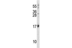ISG15 antibody western blot analysis in 293 lysate (ISG15 抗体  (AA 31-61))