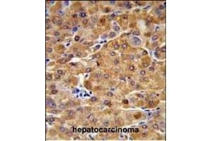 Immunohistochemistry (Paraffin-embedded Sections) (IHC (p)) image for anti-Cystathionine-beta-Synthase (CBS) (AA 104-133), (N-Term) antibody (ABIN1881141)