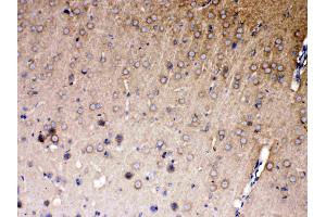 IHC analysis of NDRG3 using anti- NDRG3 antibody . (NDRG3 抗体  (AA 181-239))