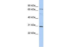 WB Suggested Anti-DMTF1 Antibody Titration:  0.