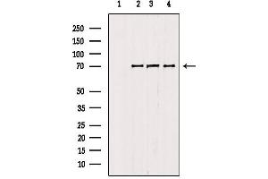 Western blot analysis of extracts from various samples, using RNF156 antibody. (Mahogunin RING Finger Protein 1 抗体  (Internal Region))