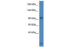 Western Blot showing Aak1 antibody used at a concentration of 1. (AAK1 抗体  (C-Term))