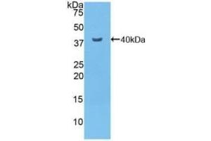 Detection of Recombinant NFkB, Mouse using Polyclonal Antibody to Nuclear Factor Kappa B (NFkB) (NFkB 抗体  (AA 40-365))
