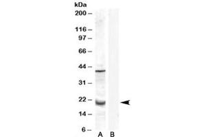 Western blot testing of human prostate lysate with GPX7 antibody at 0. (Glutathione Peroxidase 7 抗体)