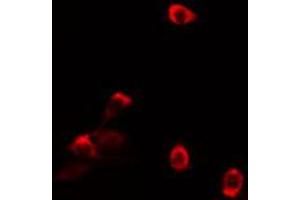 ABIN6274125 staining HT29 cells by IF/ICC. (TAF5L 抗体  (Internal Region))