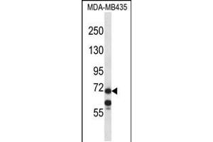 Western blot analysis in MDA-MB435 cell line lysates (35ug/lane). (MID1 抗体  (C-Term))