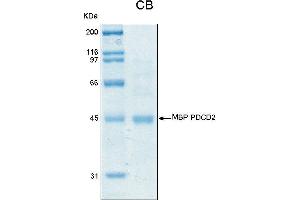 SDS-PAGE (SDS) image for Programmed Cell Death 2 (PDCD2) (AA 1-344) protein (MBP tag) (ABIN2703662)
