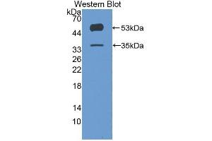 Western Blotting (WB) image for anti-Angiopoietin-Like 4 (ANGPTL4) (AA 182-388) antibody (ABIN3207381) (ANGPTL4 抗体  (AA 182-388))