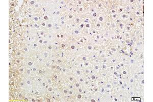 Formalin-fixed and paraffin embedded mouse liver labeled with Anti-DNTT Polyclonal Antibody, Unconjugated (ABIN681973) at 1:200 followed by conjugation to the secondary antibody and DAB staining (TdT 抗体  (AA 351-450))