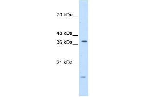 WB Suggested Anti-TFB2M Antibody Titration:  5. (TFB2M 抗体  (C-Term))