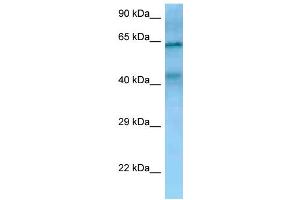 WB Suggested Anti-TIMD4 Antibody Titration: 1. (TIMD4 抗体  (N-Term))