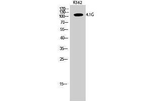 Western Blotting (WB) image for anti-erythrocyte Membrane Protein Band 4.1-Like 2 (EPB41L2) (Internal Region) antibody (ABIN3183088) (EPB41L2 抗体  (Internal Region))