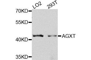 Western blot analysis of extracts of LO2 and 293T cells, using AGXT antibody. (AGXT 抗体)