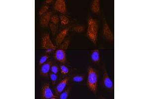 Immunofluorescence analysis of U-2 OS cells using PLK1 Rabbit pAb (ABIN3023351, ABIN3023352, ABIN3023353 and ABIN6219645) at dilution of 1:100 (40x lens). (PLK1 抗体  (AA 304-603))