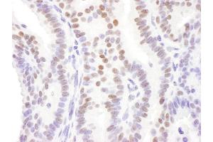 anti-Dachshund 1 (DACH1) (AA 740-760) antibody