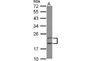 WB Image Sample (30 ug of whole cell lysate) A: HeLa 12% SDS PAGE antibody diluted at 1:1000 (PYCARD 抗体)