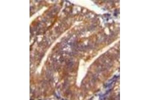 Formalin fixed and paraffin embedded human uterus tissue reacted with Periostin Antibody (C-term) followed by peroxidase conjugation of the secondary antibody and DAB staining. (Periostin 抗体  (C-Term))