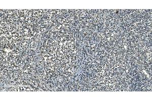 IHC analysis of LSM8 using anti-LSM8 antibody (ABIN7599579). (NAA38 抗体  (AA 1-96))