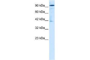 WB Suggested Anti-ZA20D1 Antibody Titration:  1. (OTUD7B 抗体  (Middle Region))