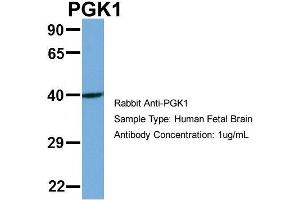 Host: Rabbit Target Name: PGK1 Sample Type: Human Fetal Brain Antibody Dilution: 1. (PGK1 抗体  (N-Term))