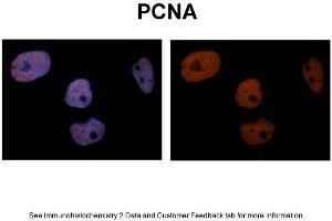 Sample Type: NT2 cells Red: Antibody Blue: DAPI Primary Dilution: 1ug/50ul antibody Secondary Antibody: Alexa goat anti-rabbit 594 Image Submitted by: Yuzhi Chen, University of Arkansas for Medical Sciences (PCNA 抗体  (C-Term))