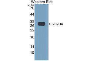 Western blot analysis of the recombinant protein. (Thyroperoxidase 抗体  (AA 636-832))