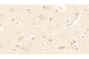 Detection of SAT1 in Human Cerebrum Tissue using Polyclonal Antibody to Spermidine/Spermine N1-Acetyltransferase 1 (SAT1) (SAT1 抗体  (AA 1-171))