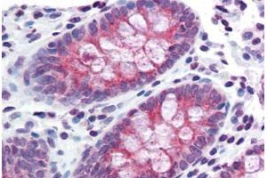 Colon, Human: Formalin-Fixed, Paraffin-Embedded (FFPE) (TMPRSS4 抗体  (Internal Region))