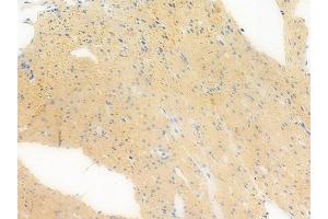 ABIN6258312 and ABIN6273385 at 1/100 staining human normal colon tissue by IHC-P. (RFPL1 抗体  (Internal Region))