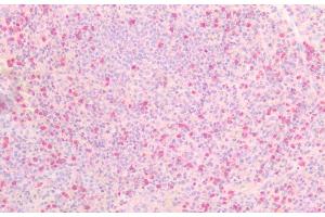 Immunohistochemistry (IHC) image for anti-Tumor Necrosis Factor Receptor Superfamily, Member 21 (TNFRSF21) (AA 406-605) antibody (ABIN7437356)