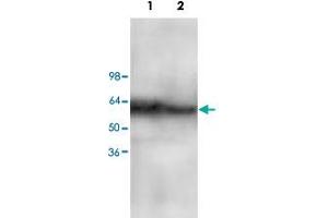 Western blot analysis of Jurkat (Lane 1) and MCF-7 (Lane 2) cell lysate with CARD10 polyclonal antibody  at 1 : 200 dilution. (CARD10 抗体  (C-Term))