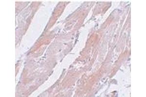 Immunohistochemistry of CCDC47 in mouse heart tissue with CCDC47 antibody at 5 μg/ml. (CCDC47 抗体  (C-Term))