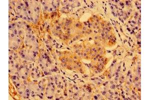 Immunohistochemistry of paraffin-embedded human pancreatic tissue using ABIN7166602 at dilution of 1:100 (PSORS1C1 抗体  (AA 1-152))