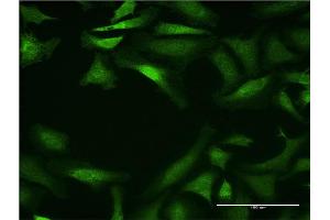 Immunofluorescence (IF) image for anti-Cytochrome P450, Family 26, Subfamily B, Polypeptide 1 (CYP26B1) (AA 131-230) antibody (ABIN527926)