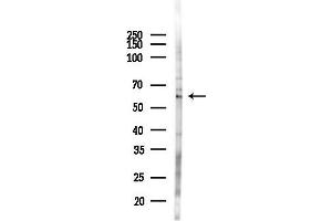 anti-Family with Sequence Similarity 82, Member A2 (FAM82A2) antibody