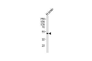 Western Blotting (WB) image for anti-Potassium Inwardly-Rectifying Channel, Subfamily J, Member 12 (KCNJ12) (AA 405-433), (C-Term) antibody (ABIN1537286)