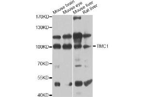 Western blot analysis of extracts of various cell lines, using TMC1 antibody (ABIN6293566) at 1:1000 dilution.
