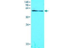 Cell lysates of MCF-7 (30 ug) were resolved by SDS-PAGE, transferred to NC membrane and probed with TDP1 monoclonal antibody, clone AT1F2  (1 : 1000). (TDP1 抗体  (AA 1-298))